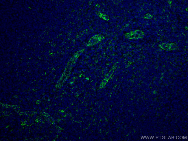 ABCA7 Antibody in Immunohistochemistry (Paraffin) (IHC (P))