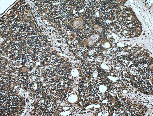 ABCA7 Antibody in Immunohistochemistry (Paraffin) (IHC (P))