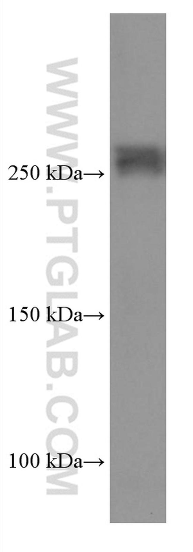 ABCA7 Antibody in Western Blot (WB)