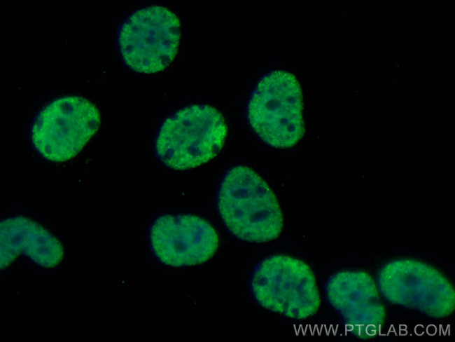 SFPQ Antibody in Immunocytochemistry (ICC/IF)