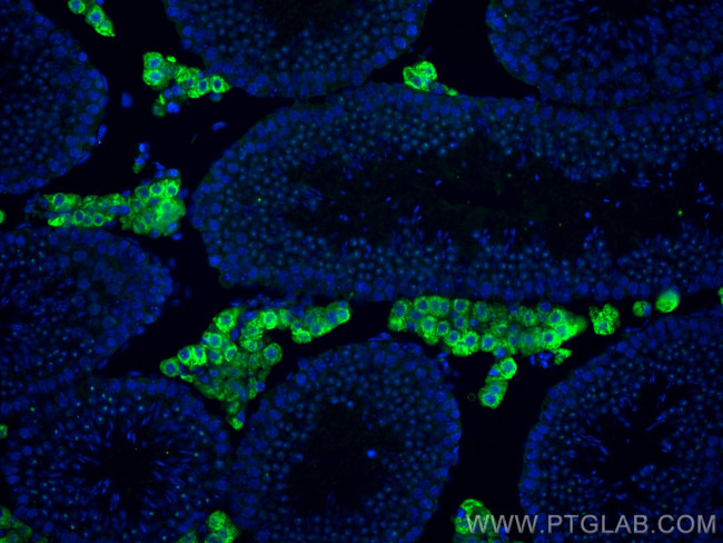 STAR Antibody in Immunohistochemistry (PFA fixed) (IHC (PFA))