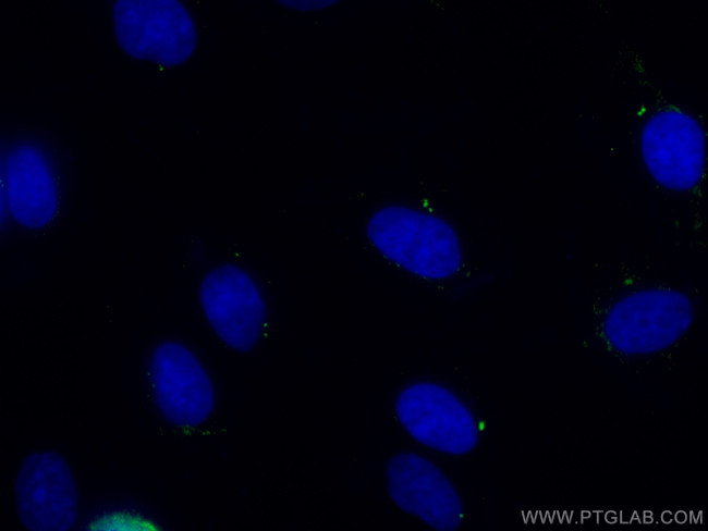 Ninein Antibody in Immunocytochemistry (ICC/IF)