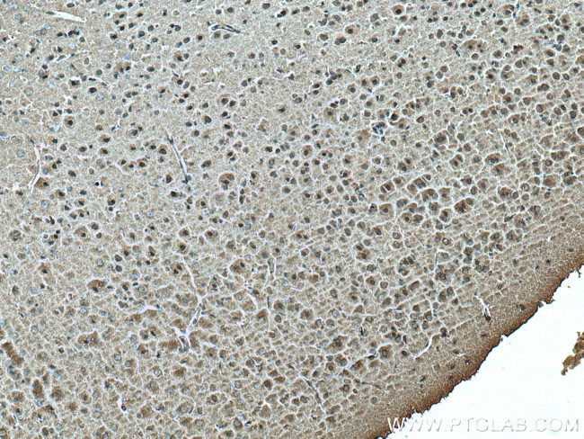 Ninein Antibody in Immunohistochemistry (Paraffin) (IHC (P))