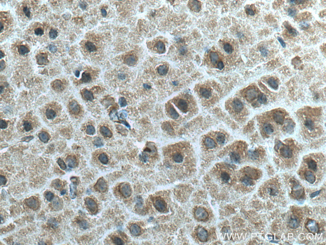 Ninein Antibody in Immunohistochemistry (Paraffin) (IHC (P))