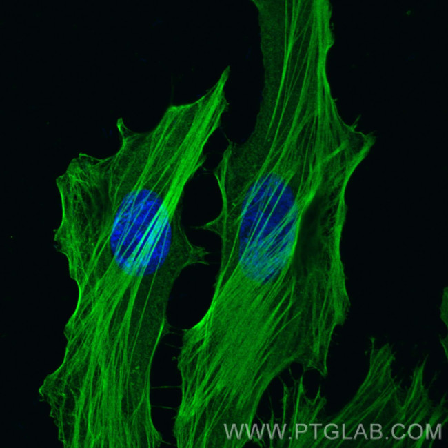 FLNA Antibody in Immunocytochemistry (ICC/IF)