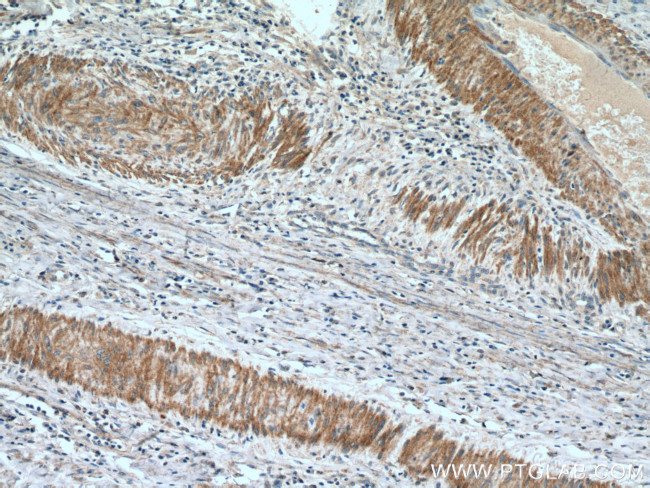 FLNA Antibody in Immunohistochemistry (Paraffin) (IHC (P))