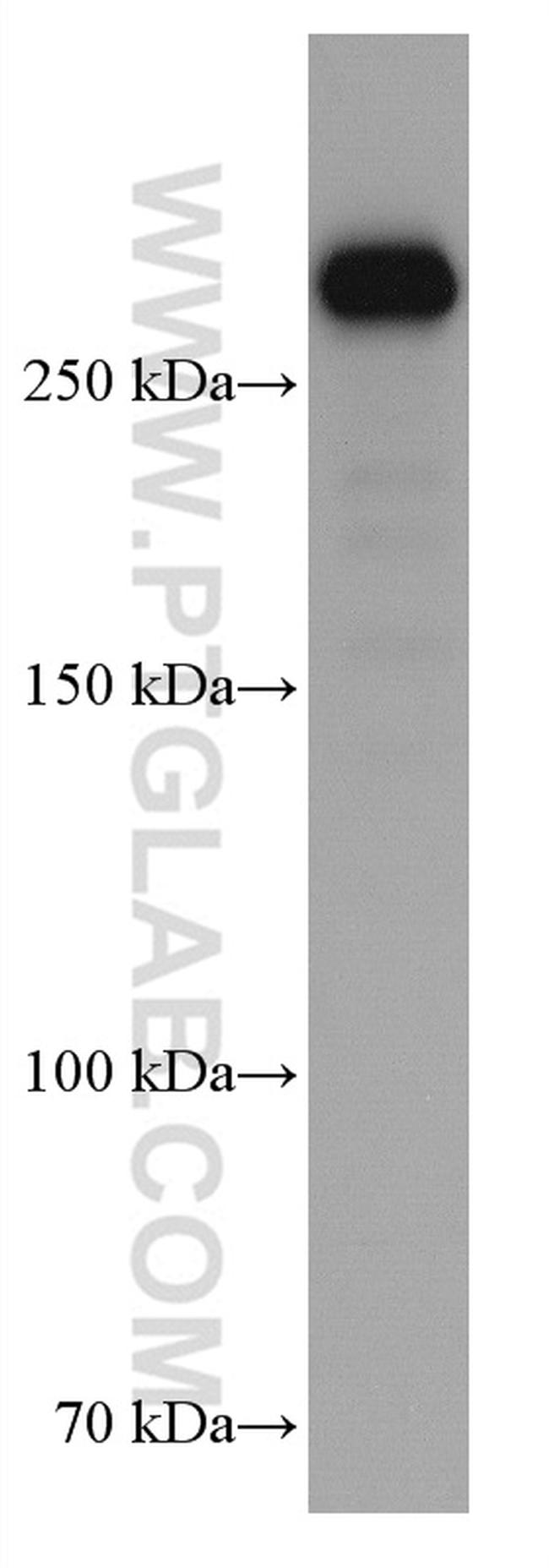 FLNA Antibody in Western Blot (WB)