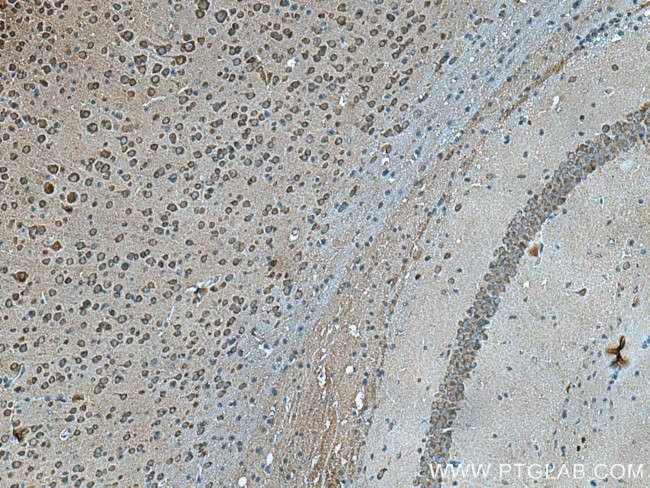 VSNL1 Antibody in Immunohistochemistry (Paraffin) (IHC (P))