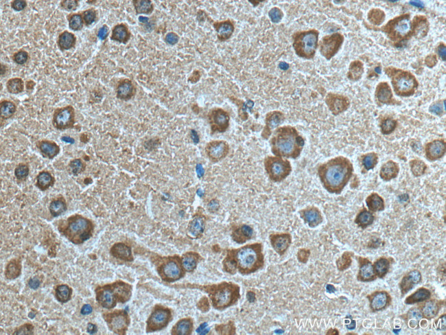 VSNL1 Antibody in Immunohistochemistry (Paraffin) (IHC (P))
