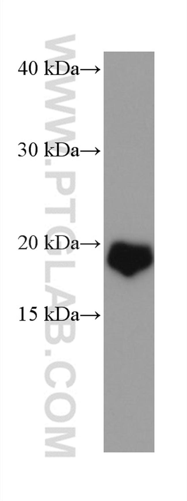 VSNL1 Antibody in Western Blot (WB)