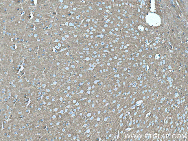 STXBP1 Antibody in Immunohistochemistry (Paraffin) (IHC (P))