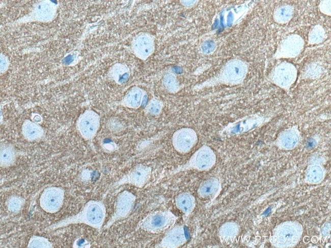 STXBP1 Antibody in Immunohistochemistry (Paraffin) (IHC (P))