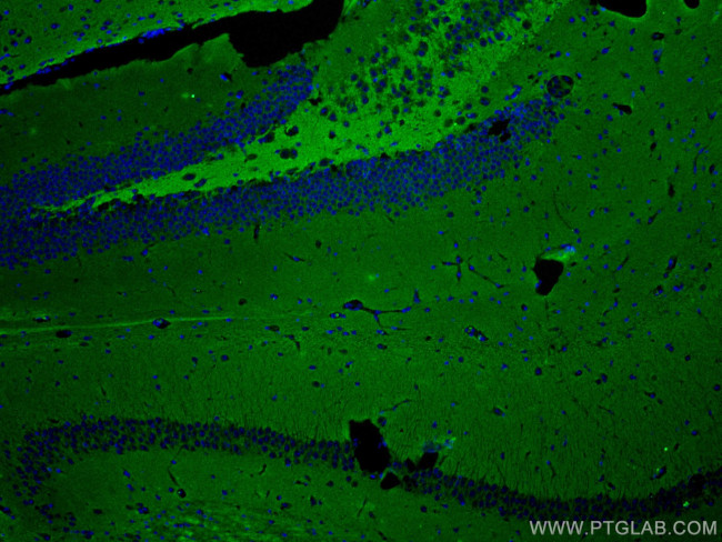 STXBP1 Antibody in Immunohistochemistry (PFA fixed) (IHC (PFA))