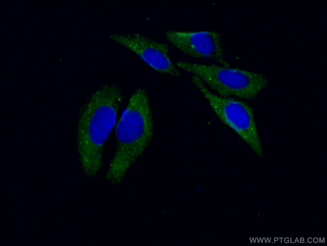 LOXL2 Antibody in Immunocytochemistry (ICC/IF)