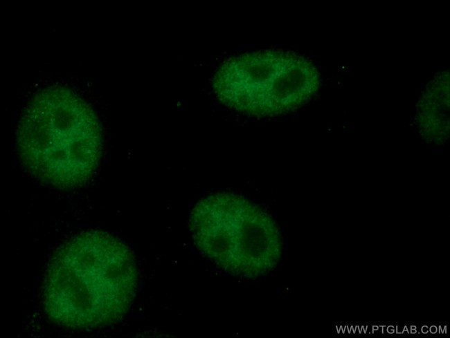 TCF3 Antibody in Immunocytochemistry (ICC/IF)