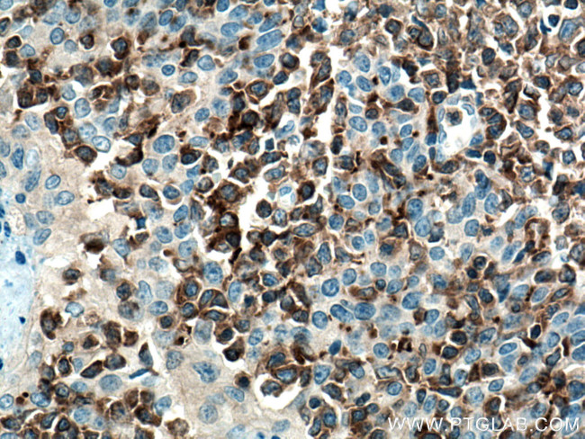 RIAM/APBB1IP Antibody in Immunohistochemistry (Paraffin) (IHC (P))