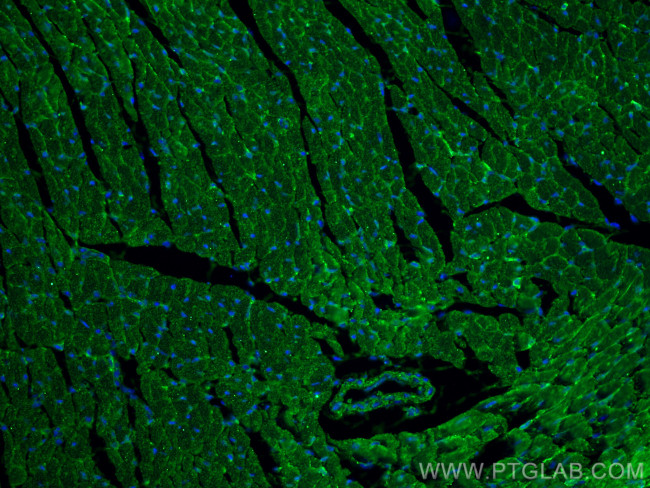 FXYD1 Antibody in Immunohistochemistry (Paraffin) (IHC (P))