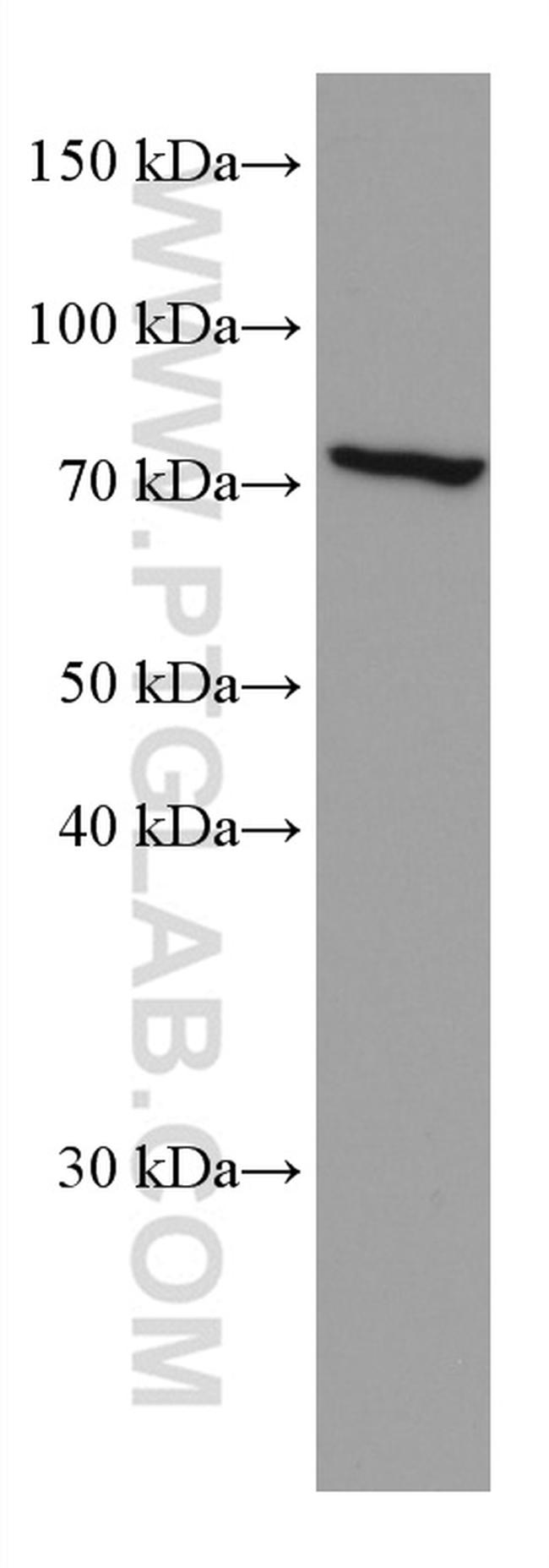 FGL2 Antibody in Western Blot (WB)