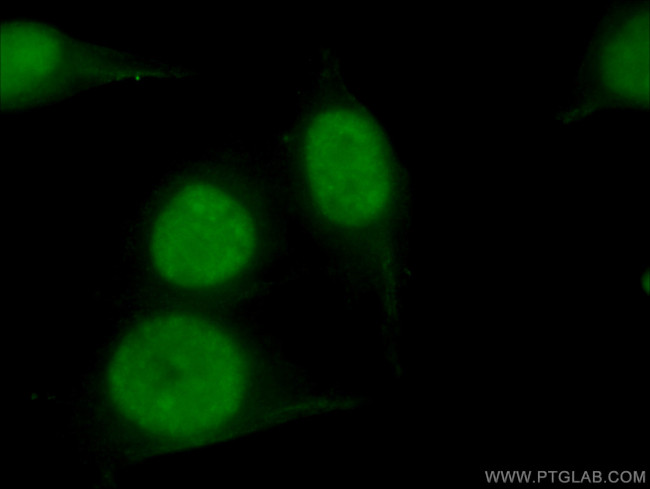 DHX9 Antibody in Immunocytochemistry (ICC/IF)