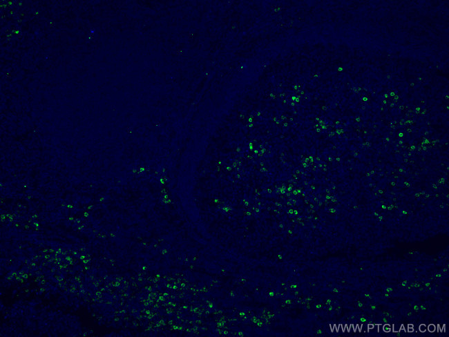 CD138/Syndecan-1 Antibody in Immunohistochemistry (Paraffin) (IHC (P))