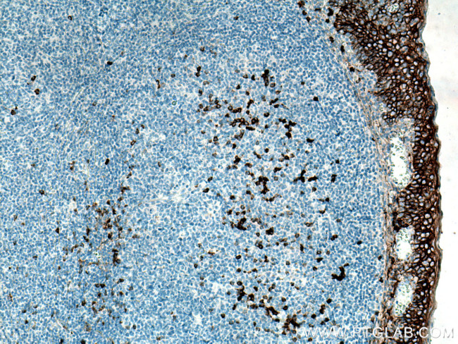 CD138/Syndecan-1 Antibody in Immunohistochemistry (Paraffin) (IHC (P))