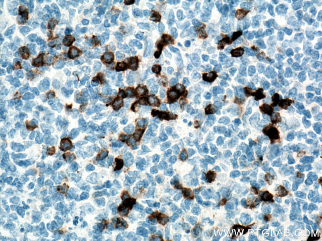 CD138/Syndecan-1 Antibody in Immunohistochemistry (Paraffin) (IHC (P))