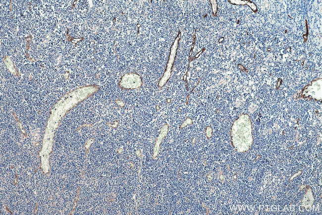 PLVAP Antibody in Immunohistochemistry (Paraffin) (IHC (P))