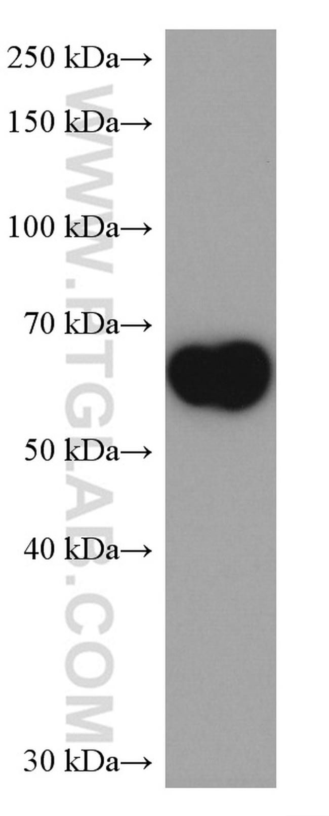 PLVAP Antibody in Western Blot (WB)