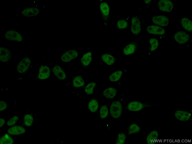 HDAC2 Antibody in Immunocytochemistry (ICC/IF)