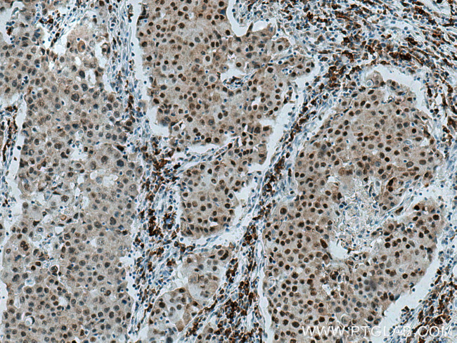 HDAC2 Antibody in Immunohistochemistry (Paraffin) (IHC (P))