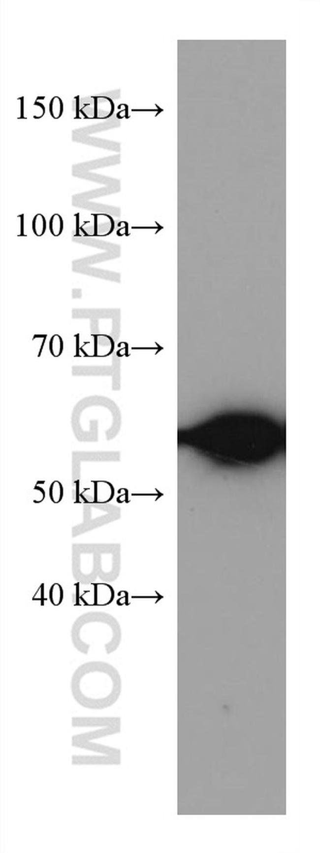 HDAC2 Antibody in Western Blot (WB)