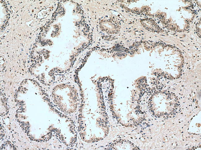 HUS1 Antibody in Immunohistochemistry (Paraffin) (IHC (P))