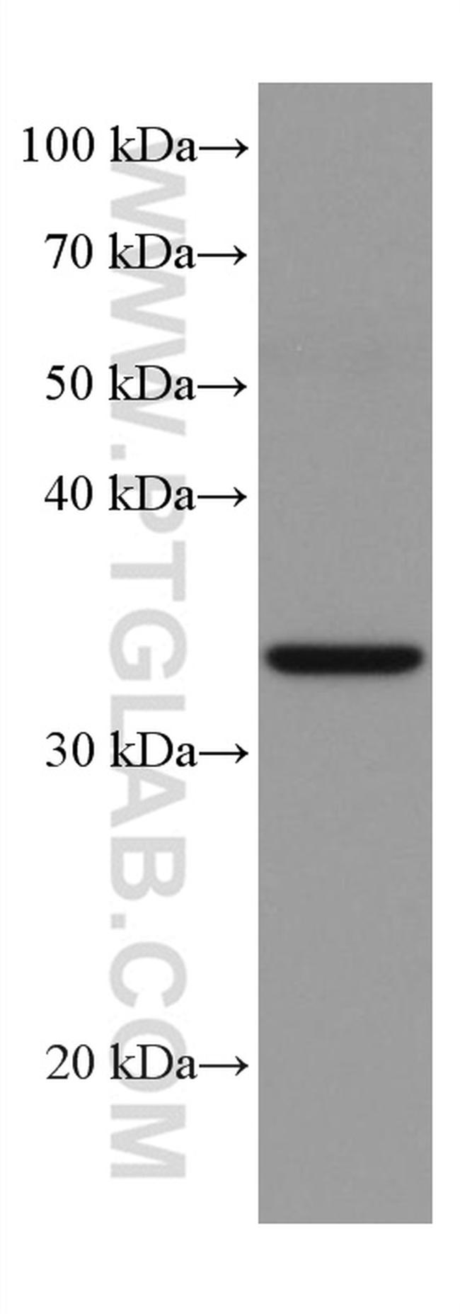 TRIB2 Antibody in Western Blot (WB)