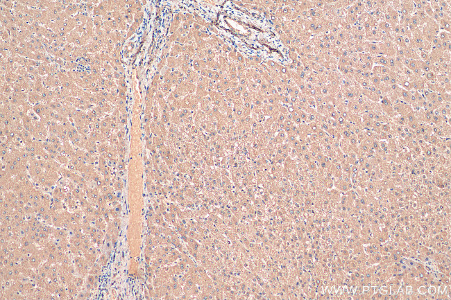 FBXO32 Antibody in Immunohistochemistry (Paraffin) (IHC (P))