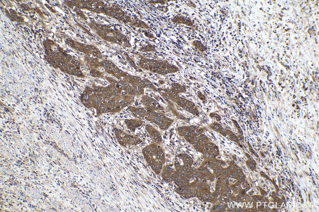 RAP1B Antibody in Immunohistochemistry (Paraffin) (IHC (P))