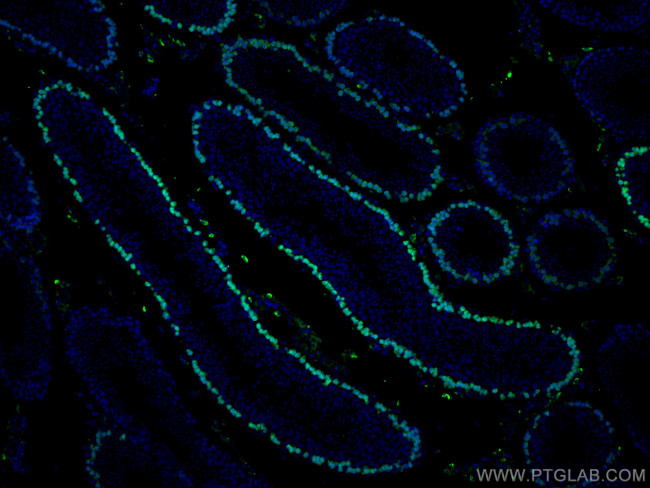 DMC1 Antibody in Immunohistochemistry (Paraffin) (IHC (P))