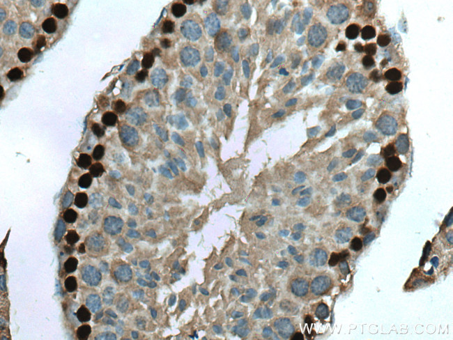 DMC1 Antibody in Immunohistochemistry (Paraffin) (IHC (P))