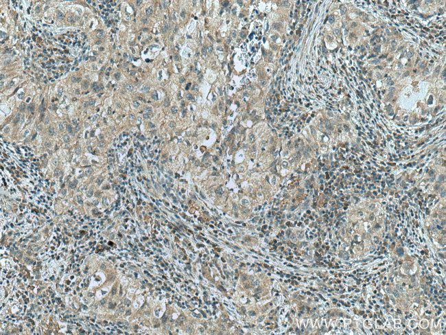 GPI Antibody in Immunohistochemistry (Paraffin) (IHC (P))