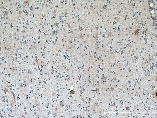 GAS1 Antibody in Immunohistochemistry (Paraffin) (IHC (P))