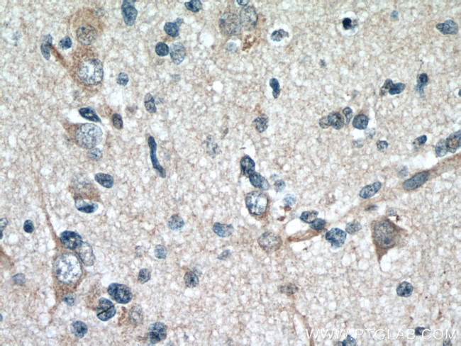 GAS1 Antibody in Immunohistochemistry (Paraffin) (IHC (P))