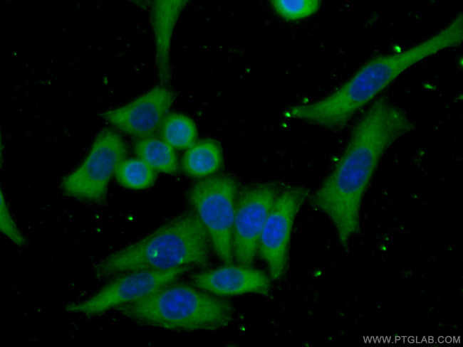 Cytohesin 2 Antibody in Immunocytochemistry (ICC/IF)