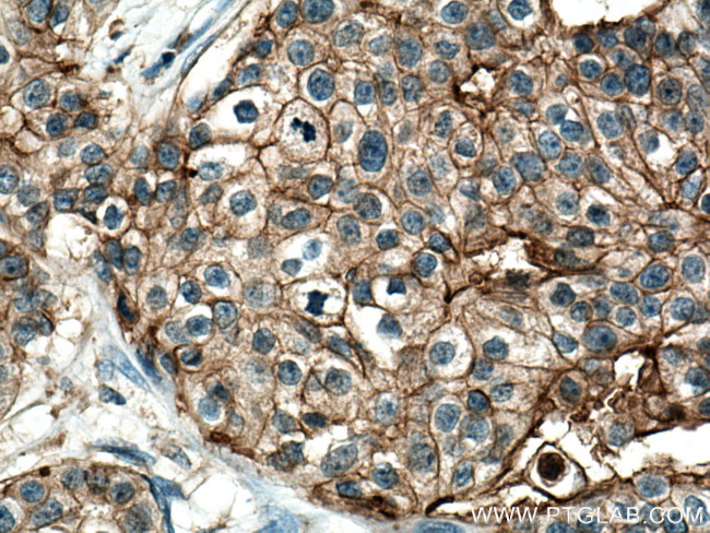 GNA13 Antibody in Immunohistochemistry (Paraffin) (IHC (P))