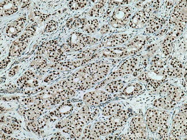 HSF1 Antibody in Immunohistochemistry (Paraffin) (IHC (P))