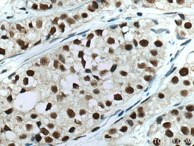 HSF1 Antibody in Immunohistochemistry (Paraffin) (IHC (P))