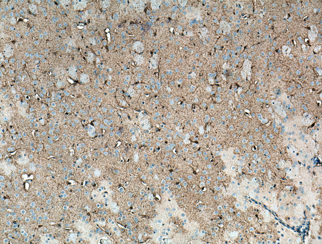 NDRG2 Antibody in Immunohistochemistry (Paraffin) (IHC (P))