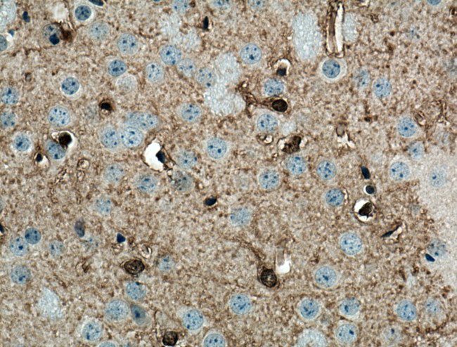 NDRG2 Antibody in Immunohistochemistry (Paraffin) (IHC (P))