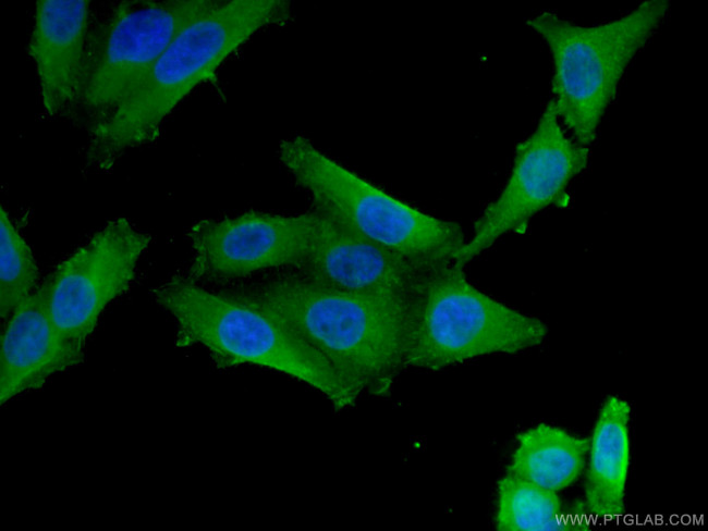 VDR Antibody in Immunocytochemistry (ICC/IF)