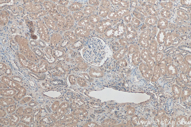 YES1 Antibody in Immunohistochemistry (Paraffin) (IHC (P))