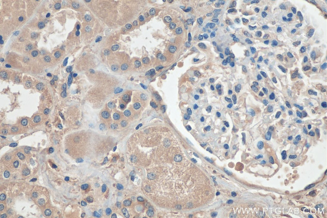 YES1 Antibody in Immunohistochemistry (Paraffin) (IHC (P))