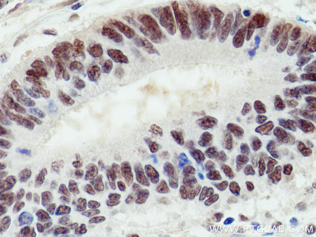 UBE1 Antibody in Immunohistochemistry (Paraffin) (IHC (P))